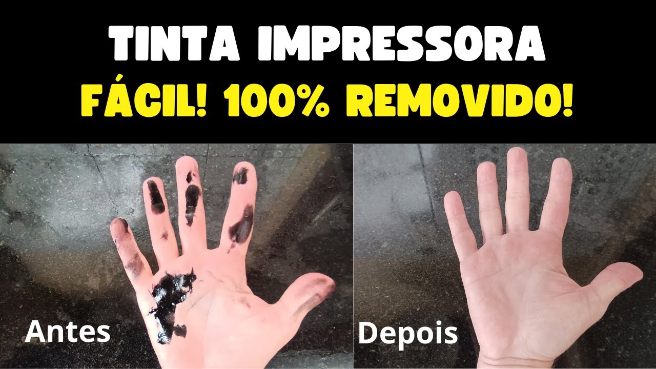 SAIBA TIRAR TINTA DE IMPRESSORA DA UNHA E MÃO. FÁCIL! - YouTube