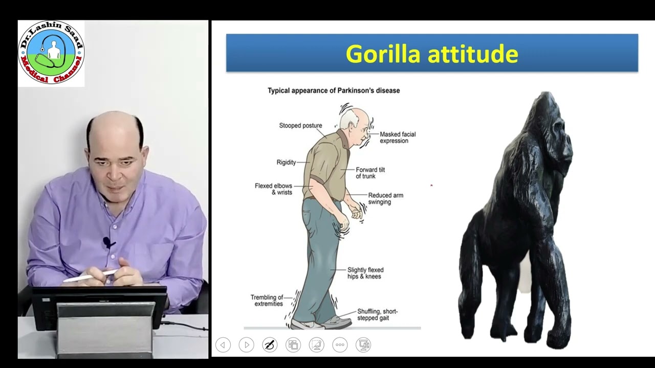 Basal  ganglia disorders - Parkinsonism- Parkinson disease - Chorea - Athetosis - Ballismus