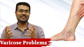 The Real Fact About Varicose Problems - Dr Manoj Johnson