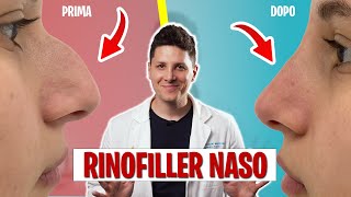 Rinofiller Correggere Il Naso Senza Chirurgia - Dott. Claudio Maestrini