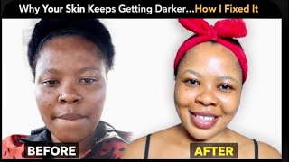 Famous Why Your Skin Keeps Getting Darker…How I Fixed It  Profile