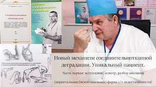 Новый механизм соединительнотканной деградации. Уникальный пациент. Часть первая.