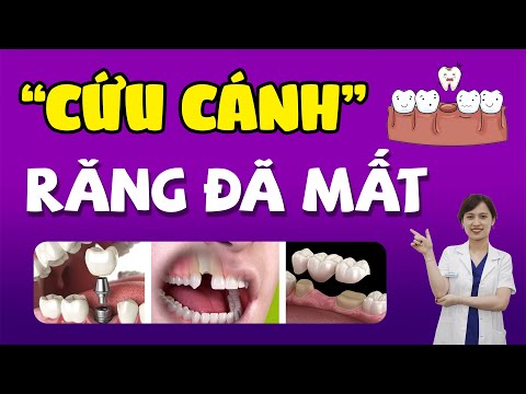cách vệ sinh răng miệng cho người niềng răng tại Kemtrinam.vn