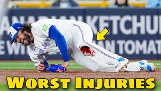 MLB | Worst Injuries April 2026