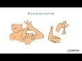 What is ehlers danlos syndrome