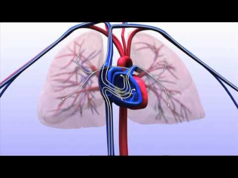 Video: Hartfalen - Symptomen, Behandeling, Oorzaken, Tekenen