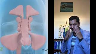 Dr. Kalyan पिनास (Sinusitis) बारे सम्पुर्ण जानकरी