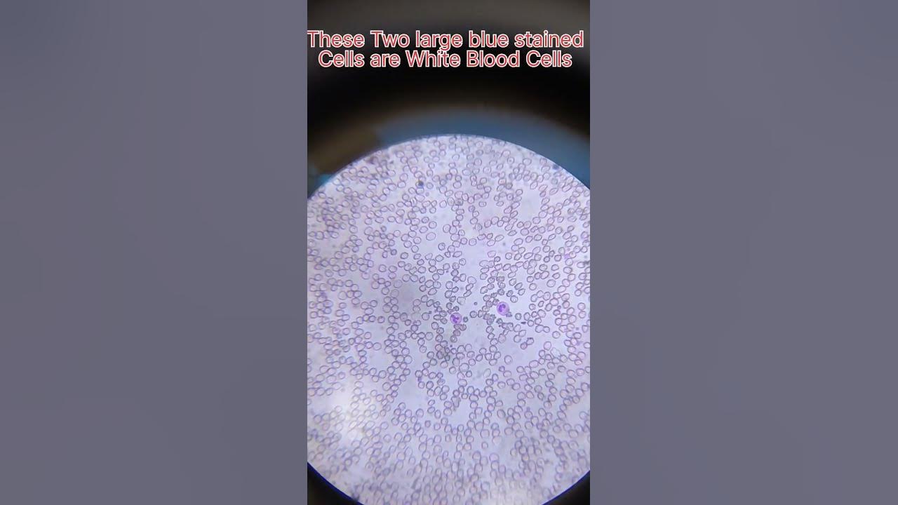 rbc-wbc-and-platelets-under-microscope-laboratory-microscope-youtube