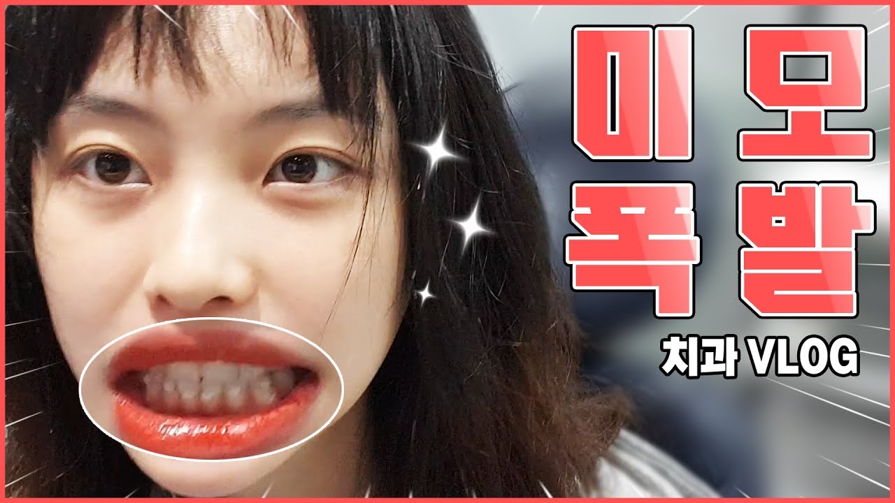 잇몸미인 말숙이의 자신감 표출 방법 | Malsook Vlog - YouTube