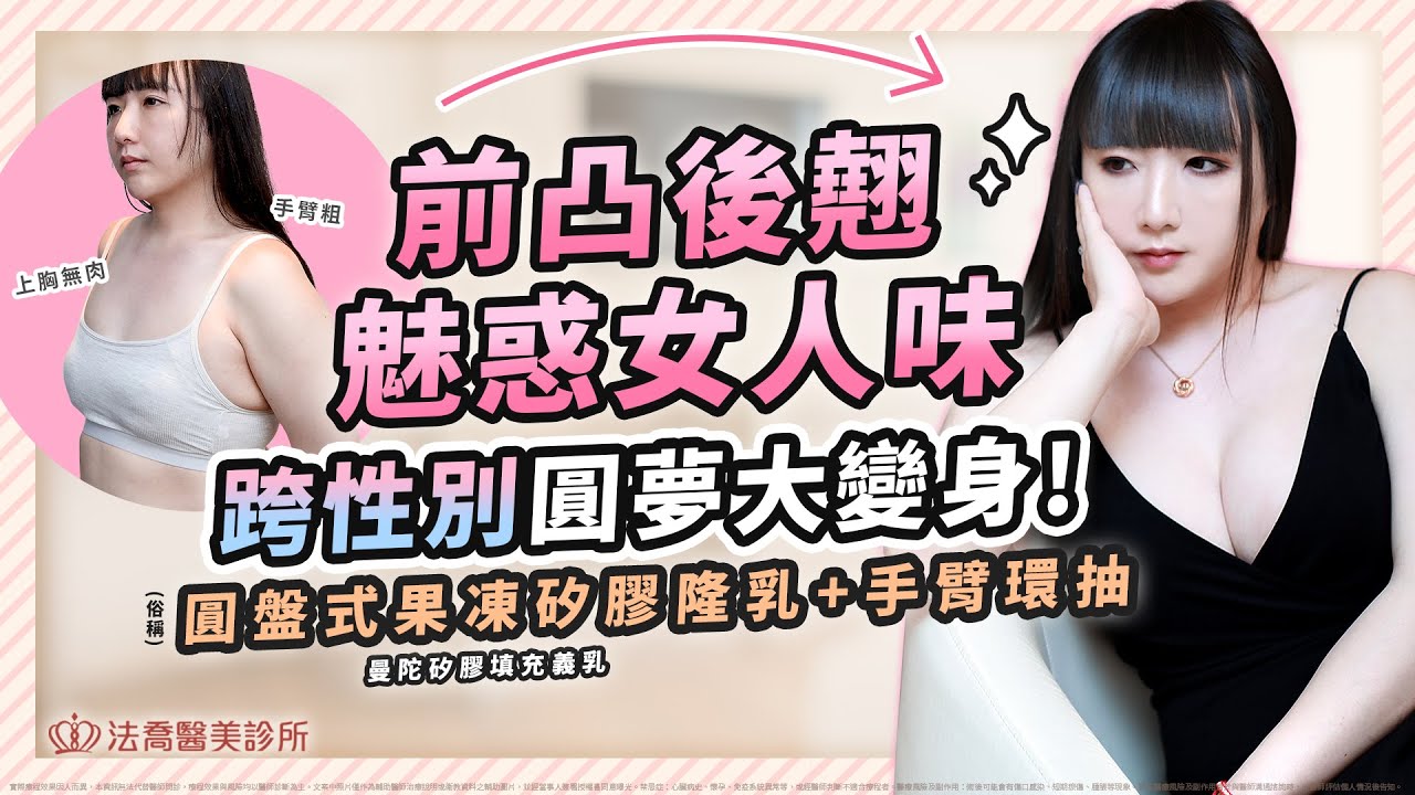 跨性別隆乳 的夢想成真之路! 改變即刻擁有，你還等什麼? - 法喬醫美診所 邱浚彥醫師衛教案例 #圓盤果凍矽膠 (俗稱)曼陀矽膠填充義乳