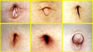 Göbek Deliğiniz Karakteriniz Hakkında Çok Şey Anlatıyor ? HANGİSİ SENİN ?