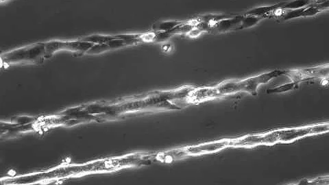 Time-lapse Microscopy showing Myoblast Fusion Into Myotubes [Folch lab]