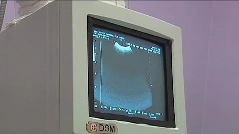 Texas 'trigger law' on abortion ban goes into effect Aug. 25