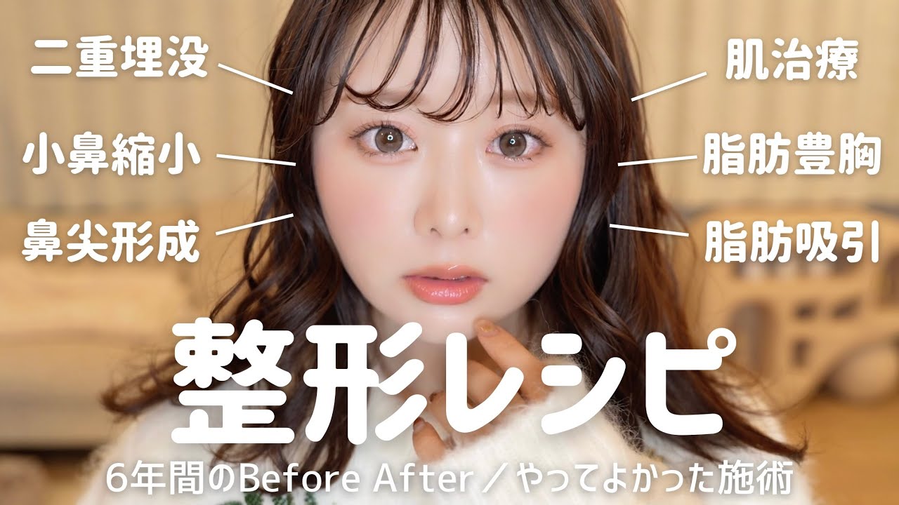 整形まとめレシピ🤍6年間の長期レポとやってよかった施術✍🏻