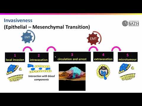 Video: Ar yra metastazių stadijos?