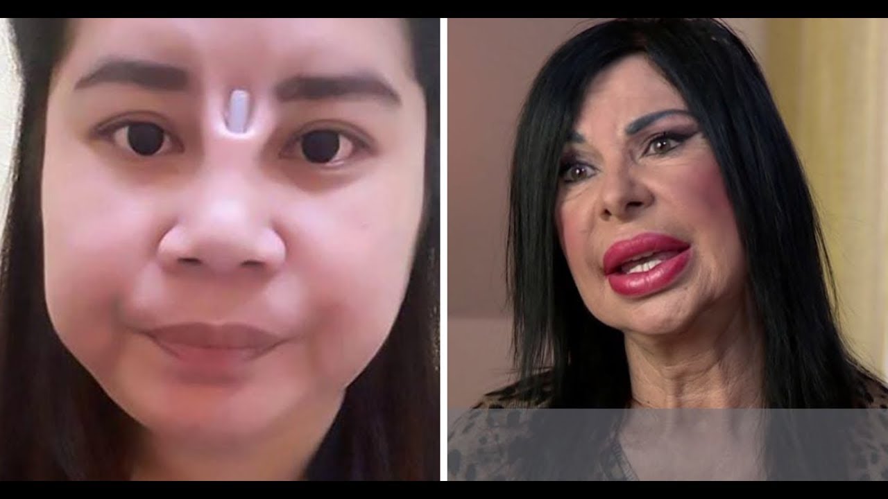 Plastic surgery fuh lo zual 2