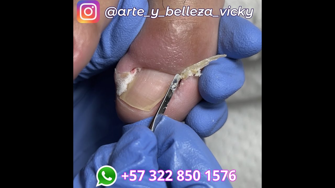 Excelente resultado al hacer cortes preventivos arte y belleza vicky