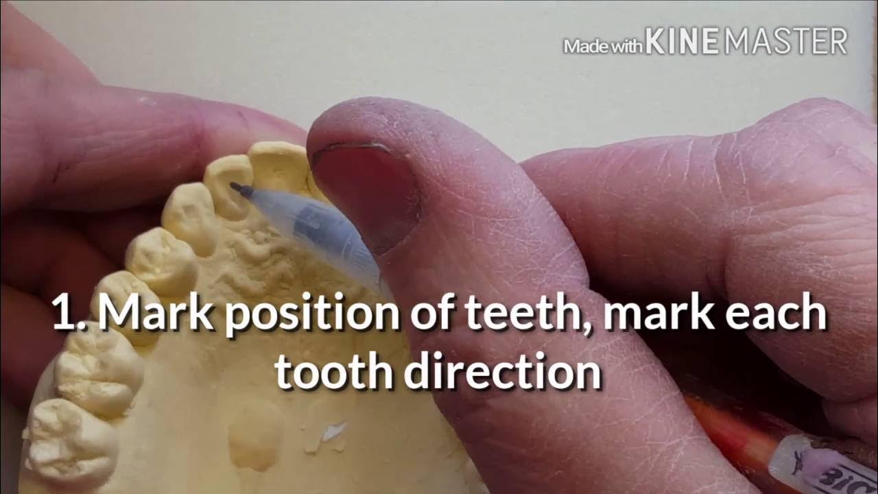 Ortho Spring Retainer lesson 1 of 4 (cutting out teeth) YouTube