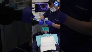 LASER Root Canal! #laser #dentistry #rootcanal #endodontic #endodontics