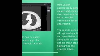 contextflow & Mint Medical Lung Cancer Screening 2025