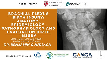 Brachial Plexus Birth Injury: Anatomy, Epidemiology, Pathophysiology, and Evaluation of Birth Injury
