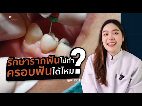 หมออธิบายเรื่องไม่ทำครอบฟัน