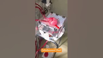 heart surgery #shortsvideo #Bypass Surgery #shorts #heart beat