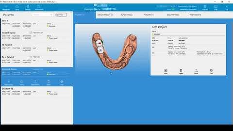 Upload Your Final Treatment Plan to Implant Concierge