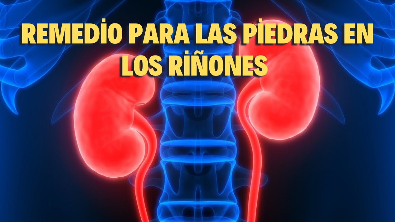 REMEDIO PARA LAS PIEDRAS EN LOS RIÑONES -Diego As - YouTube