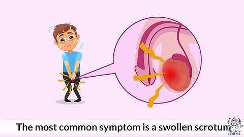 Dealing with Hydrocele: Understanding the Condition and How to Manage It