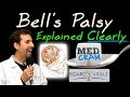 Bell's Palsy Explained Clearly - Exam Practice Question