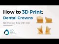 Stepbystep guide how to 3d print dental crowns using sprintray pro 55s  idd