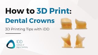 Step-By-Step Guide: How to 3D Print Dental Crowns using SprintRay Pro 55S | iDD screenshot 4