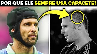 É Por Isso Que Petr Cech Nunca Tira O Capacete Aqui Está A Verdade