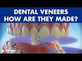 Veneers - Preparation and placement of dental veneers ©