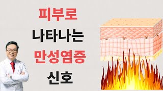 피부에 나타나는 만성염증의 신호 skin sign of chronic inflammation