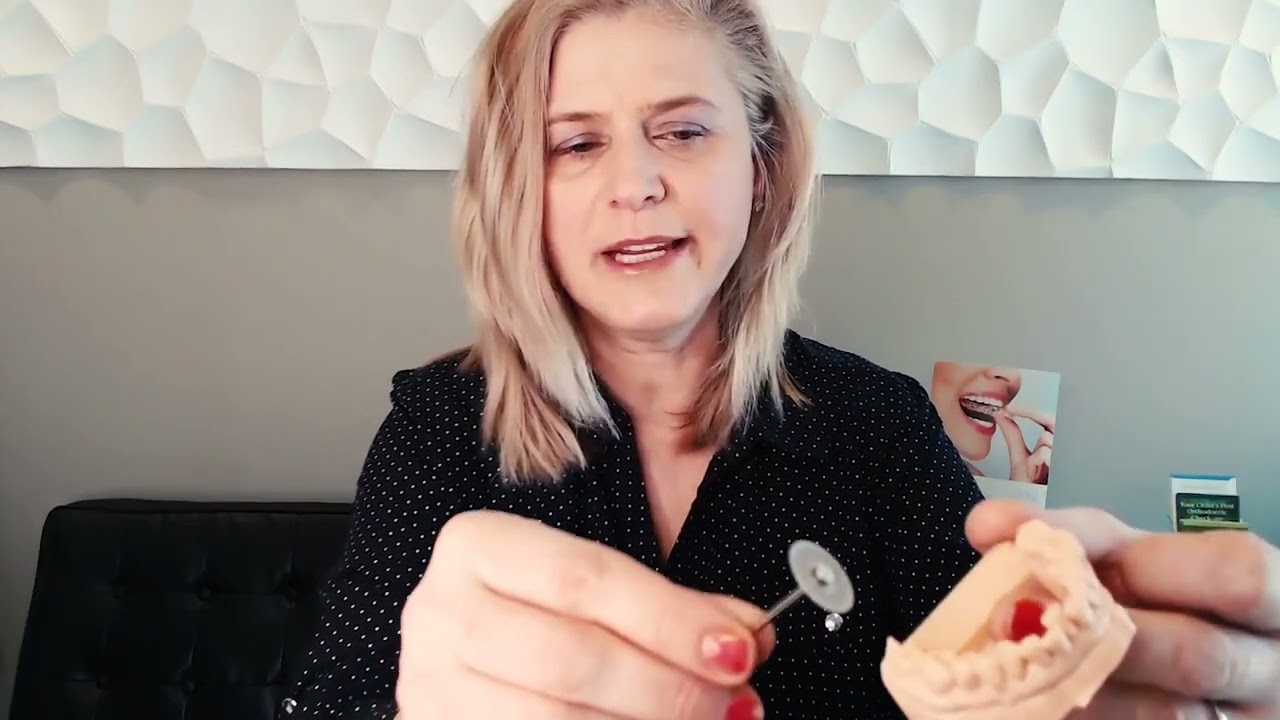 Interproximal Reduction