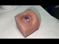 Prokera biotissue amniotic membrane insertion  removal demo  eye care training