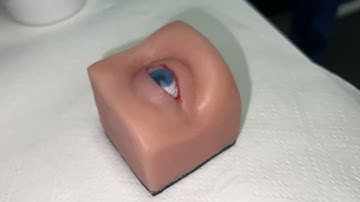 Prokera Biotissue Amniotic Membrane Insertion & Removal Demo | Eye Care Training