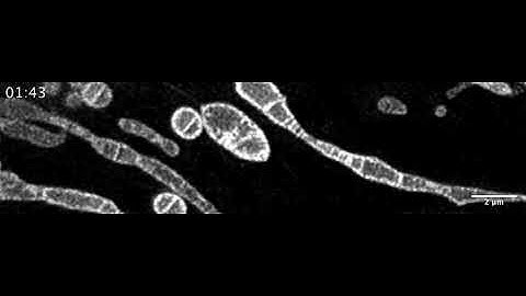 Time-lapse STED imaging of the rupture of mitochondrial membrane.