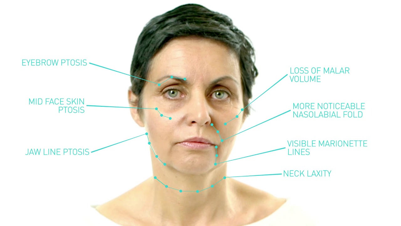 Thread Facelift YouTube