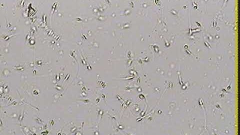 ICSI Procedure video 5