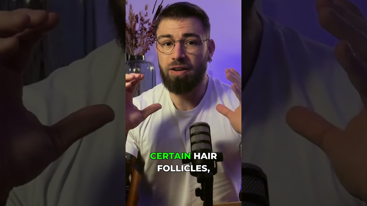 Hair loss isn't always about high testosterone