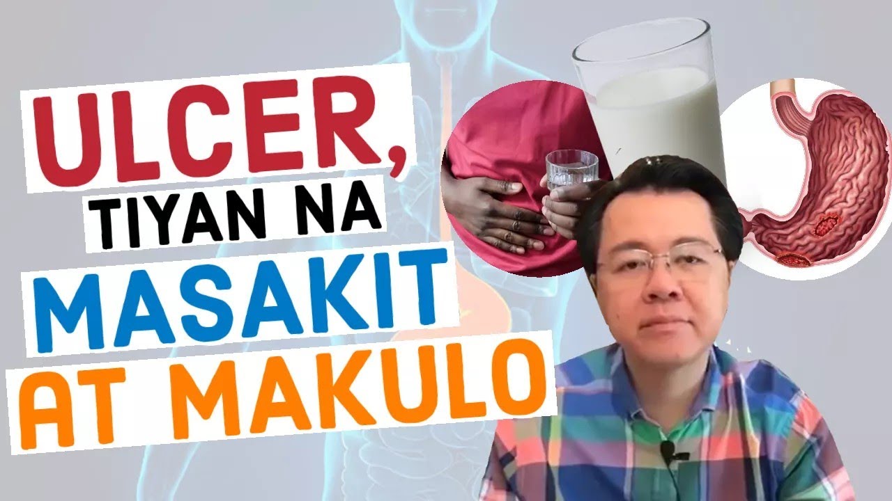 Ulcer, Tiyan na Masakit, Makulo: Alamin ang Lunas - Payo  ni Doc Willie Ong #587c