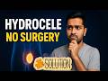Hydrocele Causes Symptoms Treatment | Testies Pain Ka ILaj | Hydrocele No Surgery in Urdu Hindi