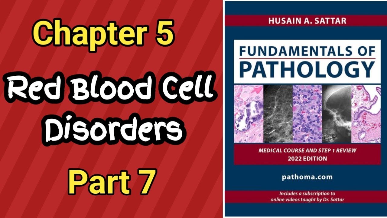 Pathoma Lectures || Chapter 5 Red Blood Cell Disorders Lecture Part 7 ...