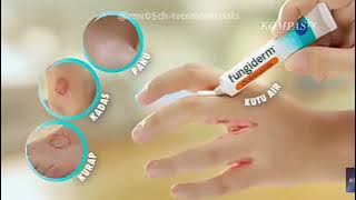 Download lagu Iklan Fungiderm - Pertandingan Bola Voli (2024)