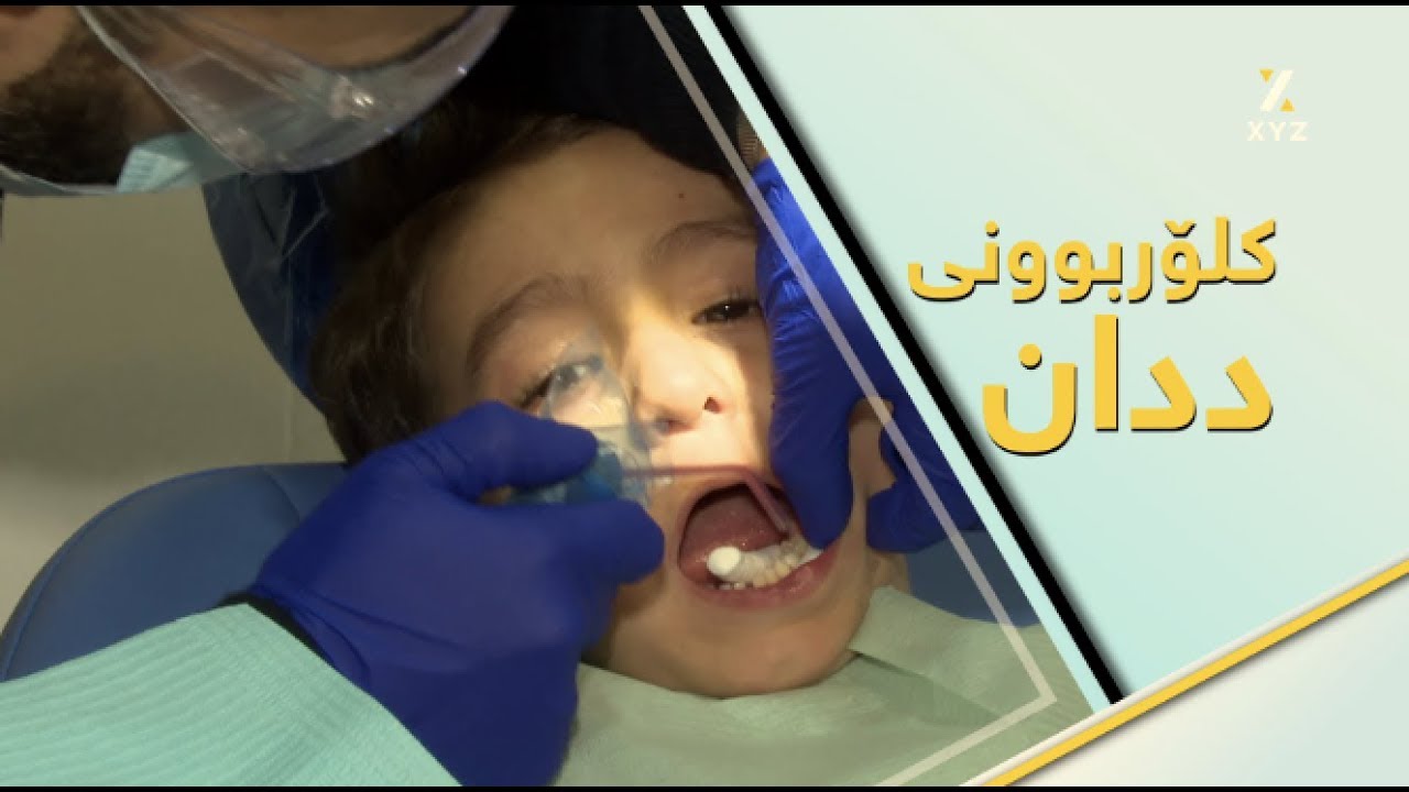 ئەو خواردن و خواردنەوانە چین کە مەترسییان بۆ کلۆربوونی ددان هەیە؟