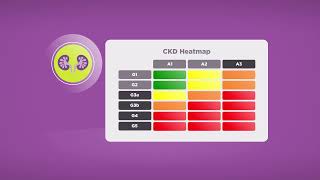 Kidney Disease Stages | CKD Heat Map | NKF Kidney Disease Stages Ckd Heat Map Nkf