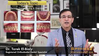#34 - Case Study - Severe Overcrowding & Overbite